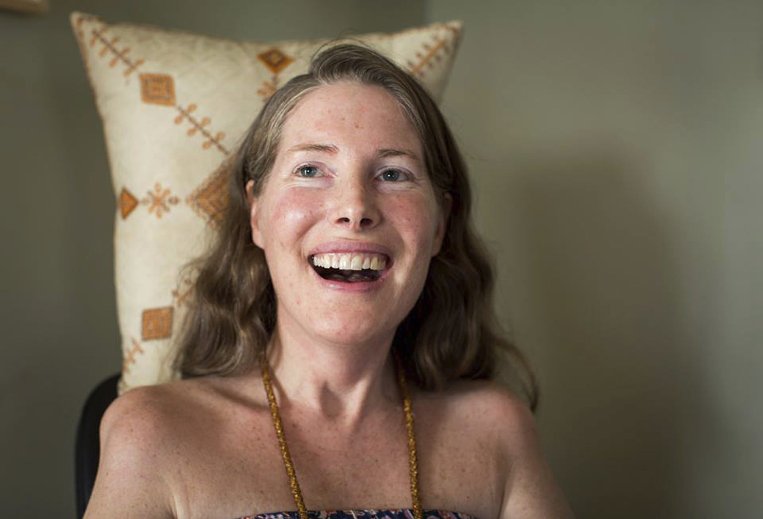 Betsy Davis smiles during her "Right To Die Party" in Ojai, Calif. Davis threw herself the party as she became one of the first to use a California law to take her own life in 2016.