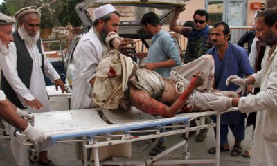 Photo of a wounded man