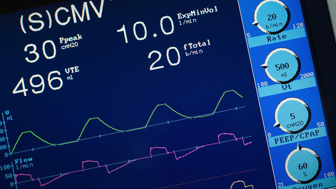 Photo of a ventilator screen