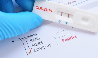 Photo of test sample marked positive for the coronavirus